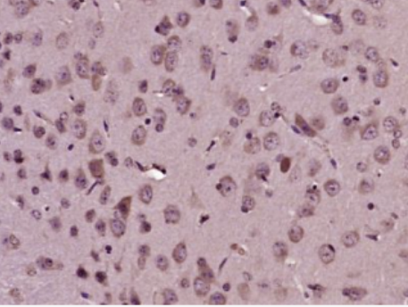 Anti-Mitofusin 2 antibody-线粒体融合蛋白Mfn2抗体.