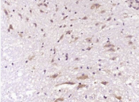 Anti-Neutrophil Elastase  antibody-中性粒细胞弹性蛋白酶ELANE抗体