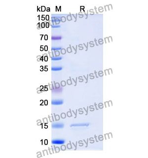 Anti-Human CNR1/CB1 Nanobody (SAA1274)