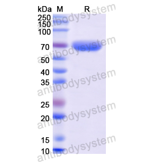 Human MMP9 Antibody (SAA0116) FHD06810