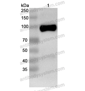 抗体：Human GRIN1/NMDAR1 Antibody (N308/48R) RHG05302