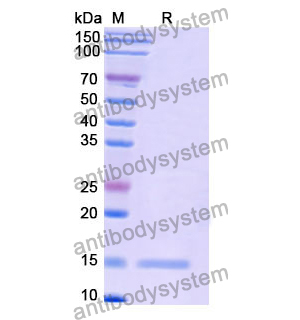 Anti-Human CD339/JAG1 Nanobody (SAA1285)