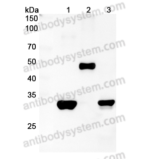 抗体：Strep Tag (WSHPQFEK) Antibody (3E8#) RGK26102