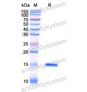 Anti-Human KLB/Beta-klotho Nanobody (SAA1184)