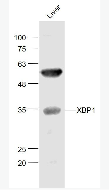 Anti-XBP1 antibody-细胞核转录因子X盒结合蛋白抗体