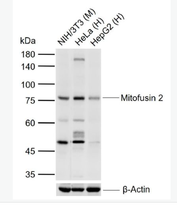 Anti-Mitofusin 2 antibody-线粒体融合蛋白Mfn2单克隆抗体