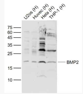 Anti-BMP2 antibody-骨形态发生蛋白2抗体