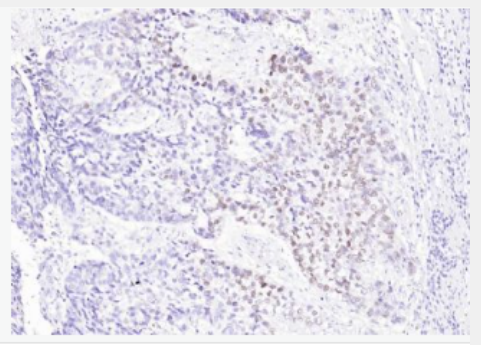 Anti-P63  antibody-肿瘤抑制基因p63α单克隆抗体