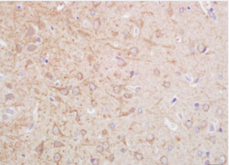 Anti-BCHE(1E8) antibody-丁酰胆碱酯酶单克隆抗体