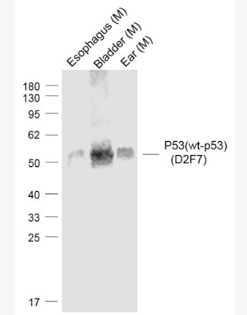 Anti-P53(wt-p53) (D2F7) antibody-肿瘤抑制基因野生型P53单克隆抗体