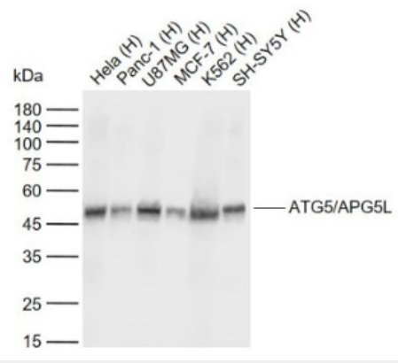 Anti-ATG5/APG5L antibody-自噬蛋白5单克隆抗体