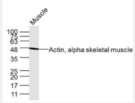 Anti-Actin, alpha skeletal muscle antibody-肌动蛋白α1单克隆抗体