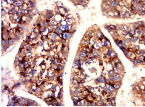 Anti-CEA(B5) antibody-癌胚抗原单克隆抗体（检测）