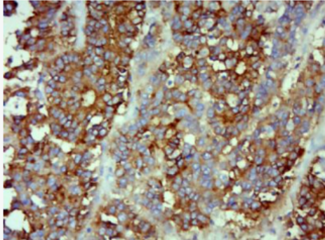 Anti-CEA(C3) antibody-癌胚抗原单克隆抗体（包被）