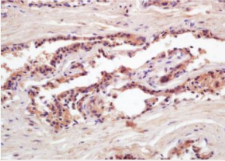 Anti-PSA(Pa3)antibody-人前列腺特异性抗原单克隆抗体(包被)