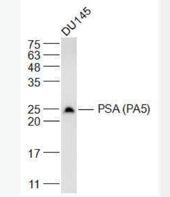Anti-PSA (PA5)  antibody-人前列腺特异性抗原单克隆抗体(检测)