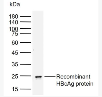 Anti-HBcAg antibody-人乙型肝炎核心抗原单克隆抗体