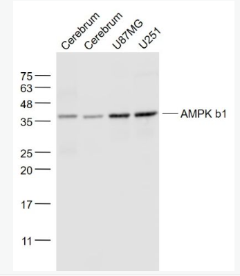 Anti-AMPK b1 antibody-腺苷单磷酸活化蛋白激酶β1单克隆抗体