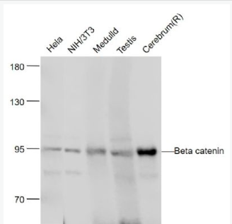 Anti-Beta catenin antibody-β-连环蛋白/β-连环素/β链接素单克隆抗体.