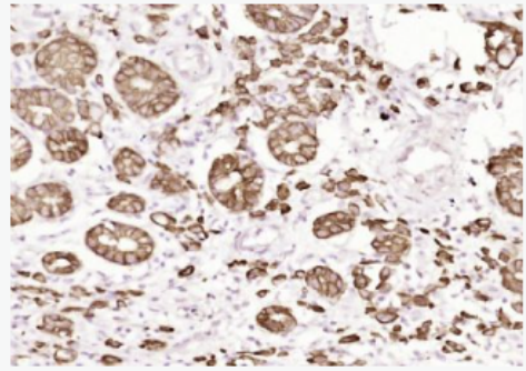 Anti-Pan Cytokeratin  antibody-广谱细胞角蛋白PCK单克隆抗体