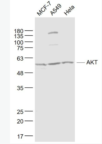 Anti-AKT antibody-蛋白激酶B单克隆抗体