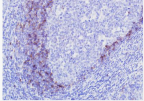 Anti-CD23 antibody-CD23/FcεRII单克隆抗体