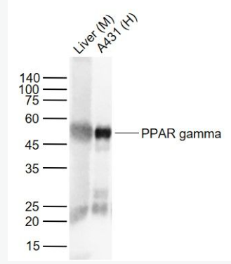 Anti-PPAR gamma antibody-过氧化酶活化增生受体γ单克隆抗体