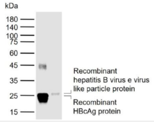 Anti-HBeAg  antibody-人乙型肝炎e抗原单克隆（包被）抗体