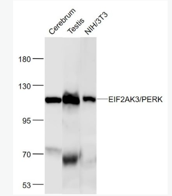 Anti-EIF2AK3/PERK  antibody-蛋白激酶样内质网激酶单克隆抗体