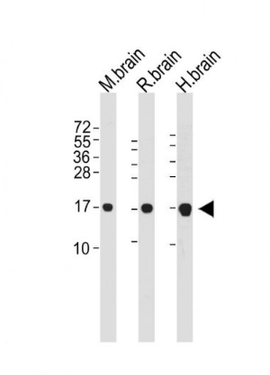 Anti-LC3  antibody-自噬微管相关蛋白轻链3单克隆抗体