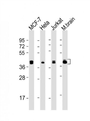 Anti-ERK1 antibody-丝裂原活化蛋白激酶1(MAPK3/1)单克隆抗体