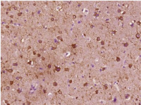 Anti-MAP2 antibody-微管相关蛋白2单克隆抗体