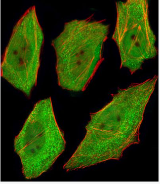 Anti-TNF alpha antibody-肿瘤坏死因子-α单克隆抗体