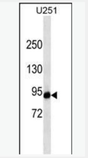 Anti-HIF-1 Alpha antibody-缺氧诱导因子1α单克隆抗体