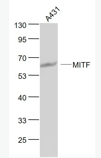 Anti-MITF antibody-微小细胞血症相关转录因子单克隆抗体