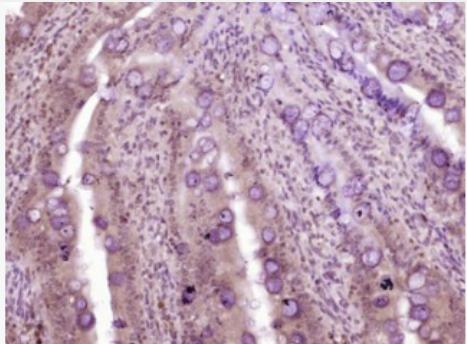 Anti-CDX2 antibody-尾型同源盒转录因子2单克隆抗体