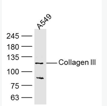 Anti-Collagen III antibody-III型胶原单克隆抗体