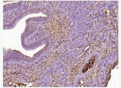 Anti-Progesterone Receptor  antibody-孕激素受体单克隆抗体