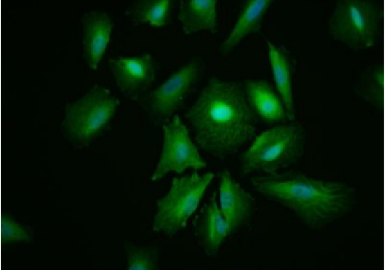 Anti-HSV-Tag antibody-HSV tag标签单克隆抗体