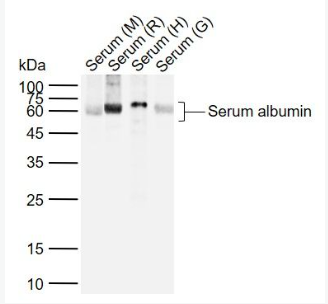 Anti-Human Serum albumin (Loading Control) antibody-白蛋白（内参）抗体