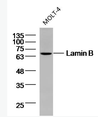 Anti-Lamin B (Nuclear Loading Control) antibody-核纤层蛋白B（核内参）单克隆抗体