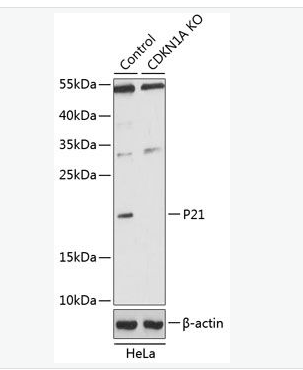 Anti-p21 antibody-p21蛋白抗体