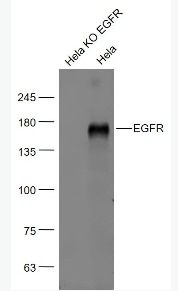 Anti-EGFR antibody-表皮生长因子受体单克隆抗体