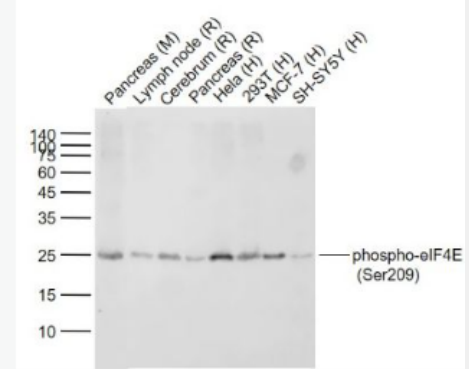 Anti-phospho-eIF4E (Ser209) antibody-磷酸化真核翻译起始因子4E重组兔单抗