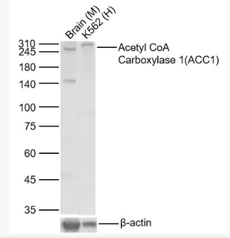 Anti-ACACAantibody-乙酰辅酶A羧化酶重组兔单抗