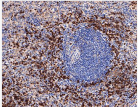 Anti-CD63 antibody-黑色素瘤相关抗原重组兔单抗