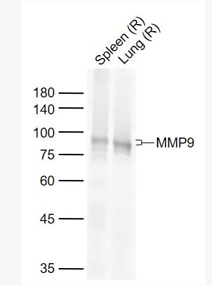 Anti-MMP9 antibody-基质金属蛋白酶-9重组兔单抗