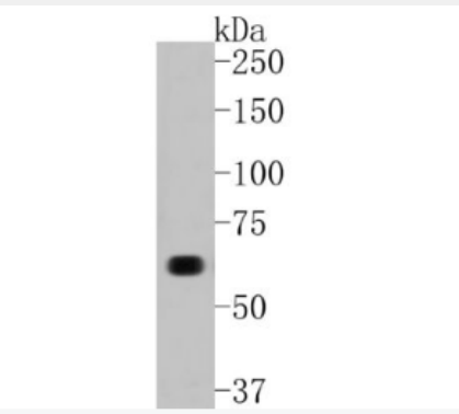 Anti-COL10A1 antibody-COL10A1重组兔单抗