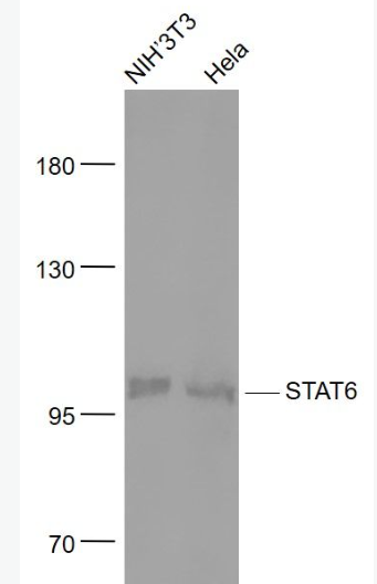 Anti-STAT6 antibody-信号转导和转录激活因子6重组兔单抗