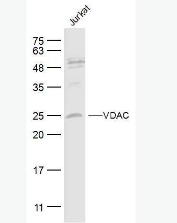 Anti-VDAC (Mitochondrial Loading Control)antibody-等电压依赖性阴离子通道（内参）抗体